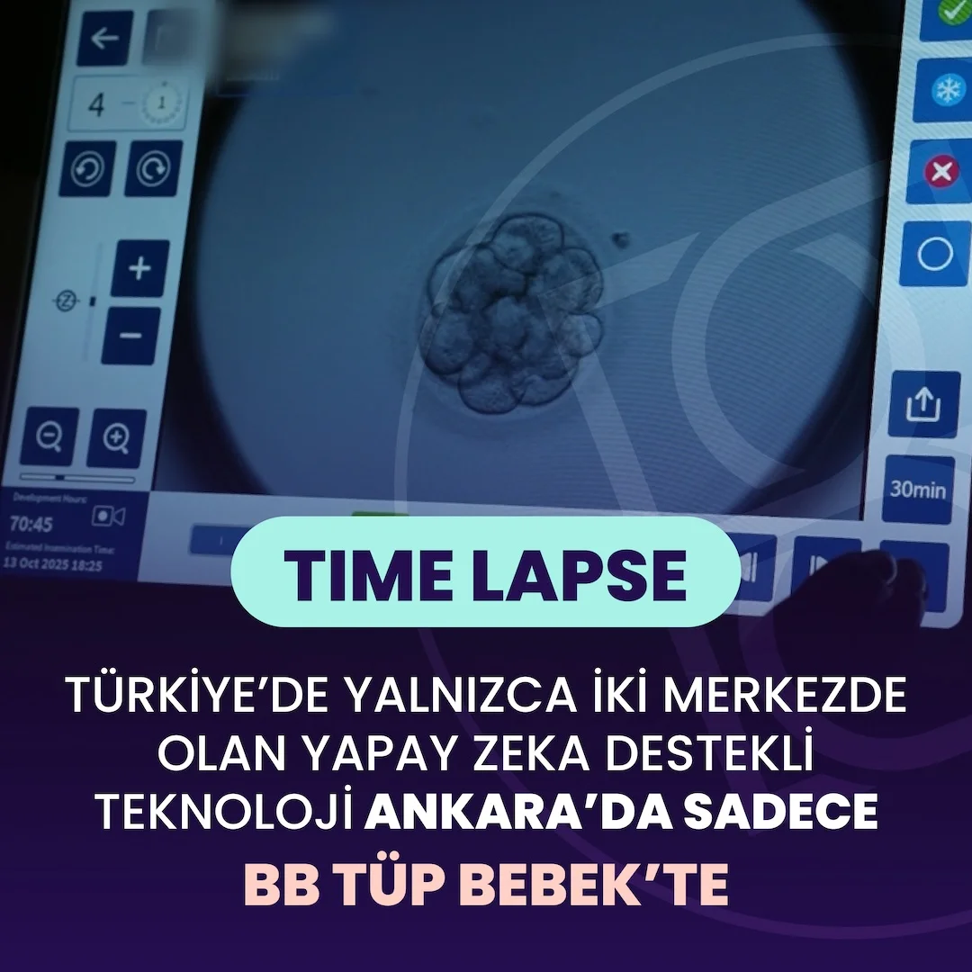 bbtupbebek-time-lapse